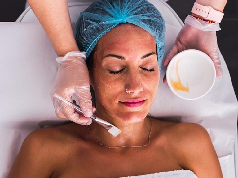 Chemical Peel Specialist