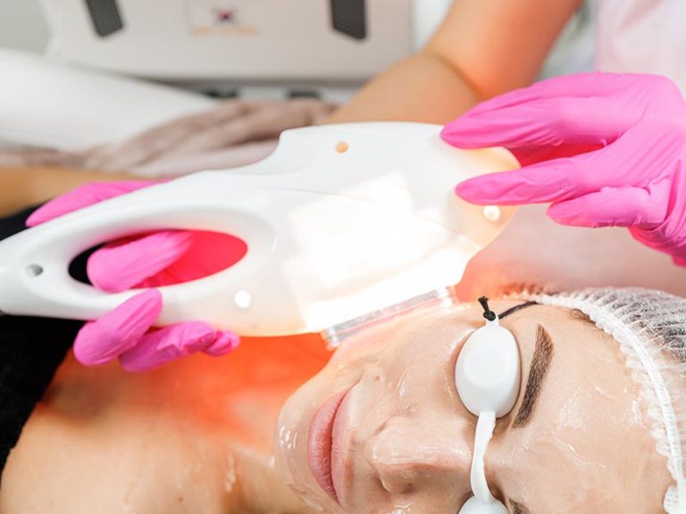 Intense Pulsed Light (IPL) Treatment