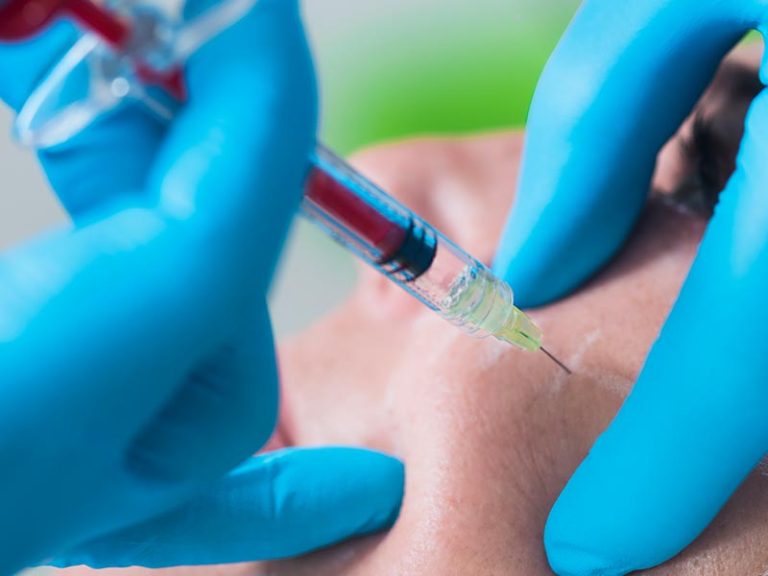 Platelet-Rich Plasma (PRP)